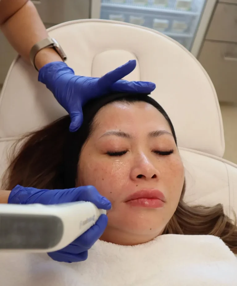 Dermapen 4 Medical Skin Needling