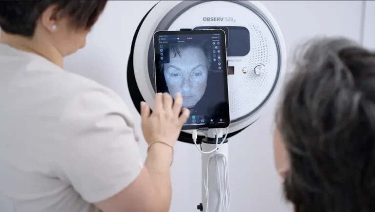 Observ 520 Digital Skin Analysis