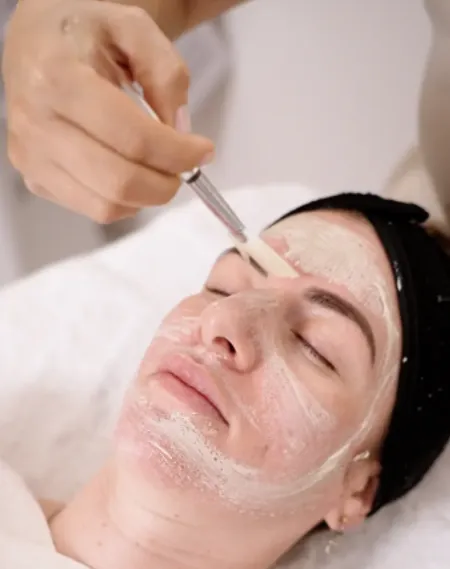 Medical Grade Chemical Peels
