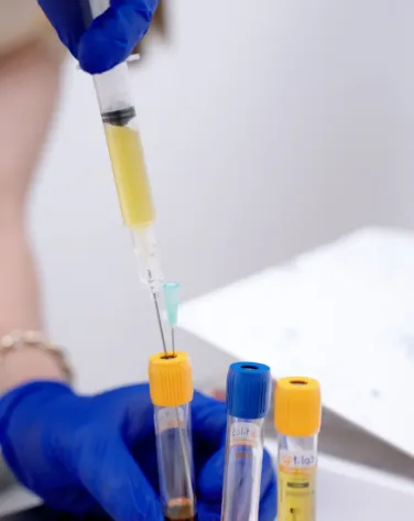 Sunrise Aesthetic Treatment - PRP & PRF Autologous Rejuvenation