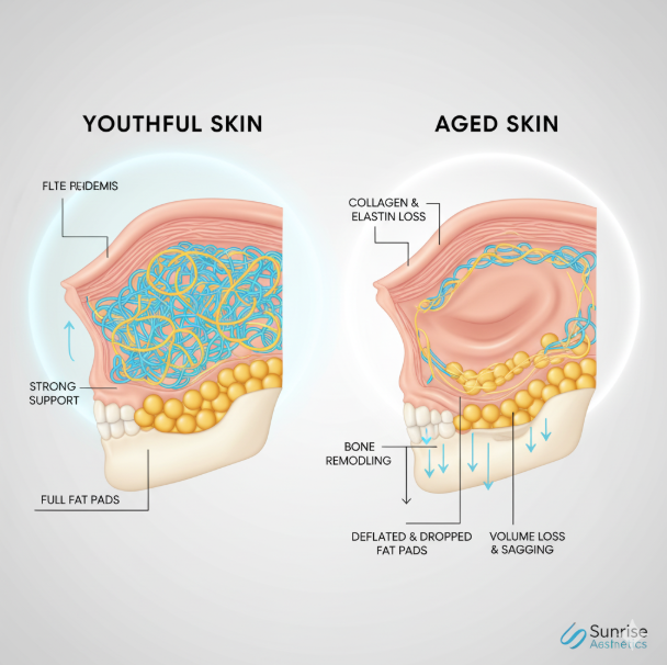 Why Has My Face Lost Volume? Causes & Early Signs of Ageing